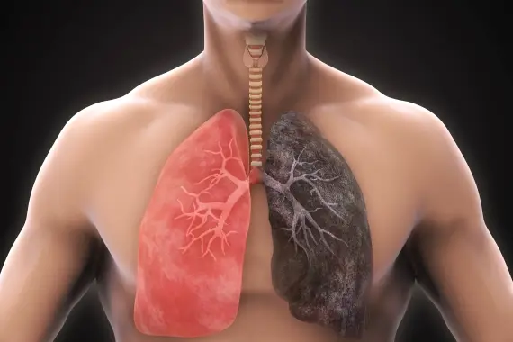 النيكوتين.. هكذا تنظف جسمك منه بعد الإقلاع عن التدخين وتخطي اليوم الثالث
